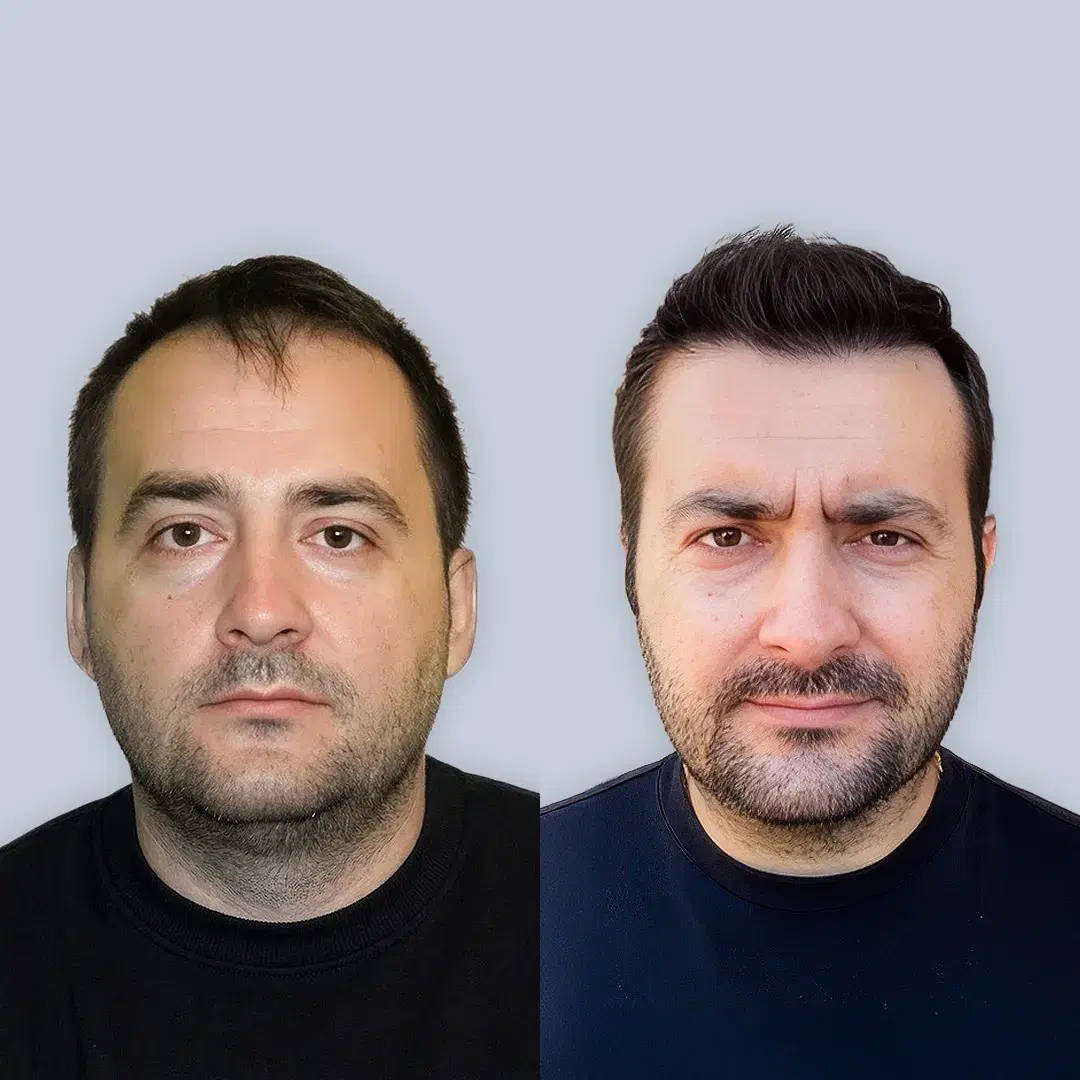 Ahmet Yilmaz