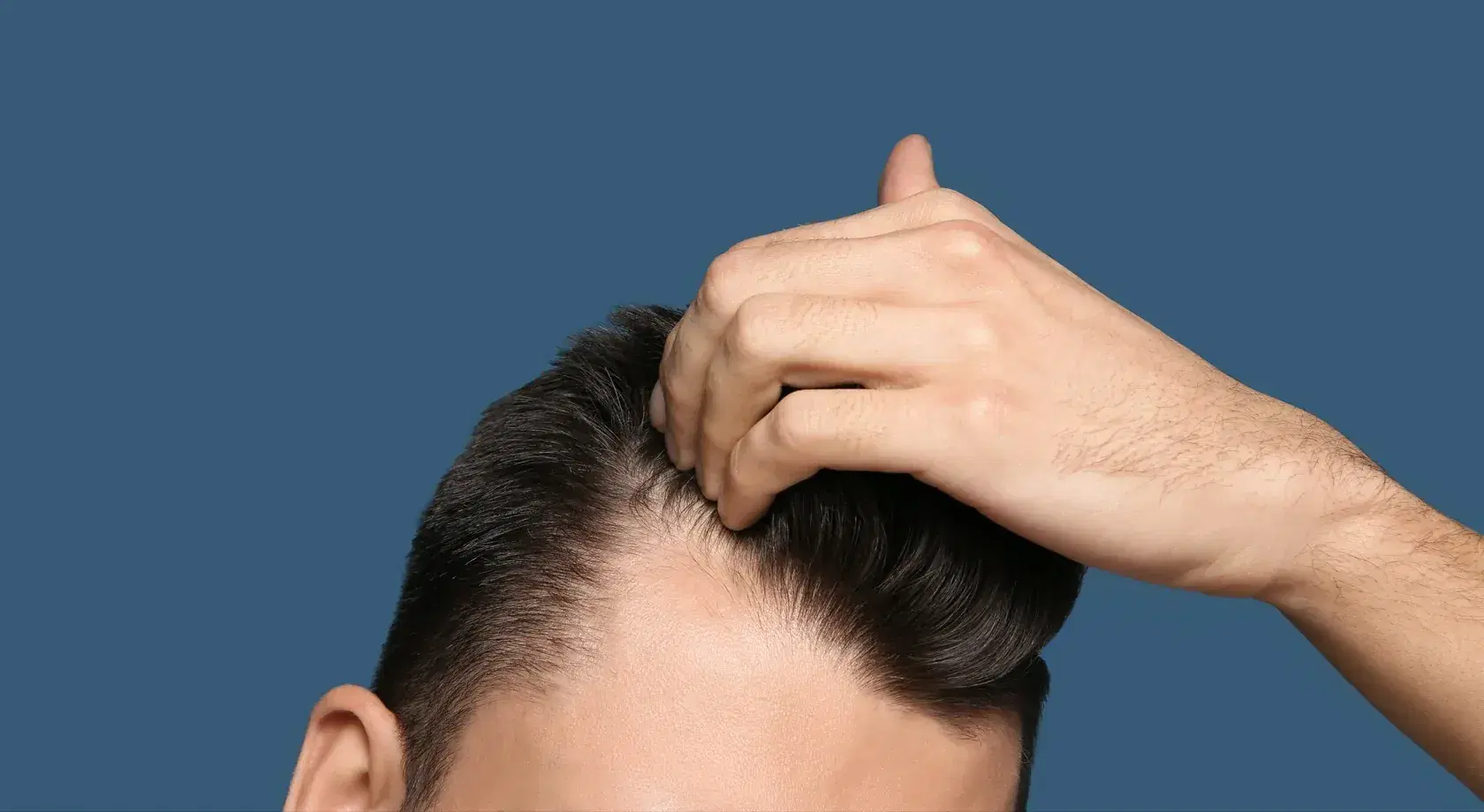 hair loss