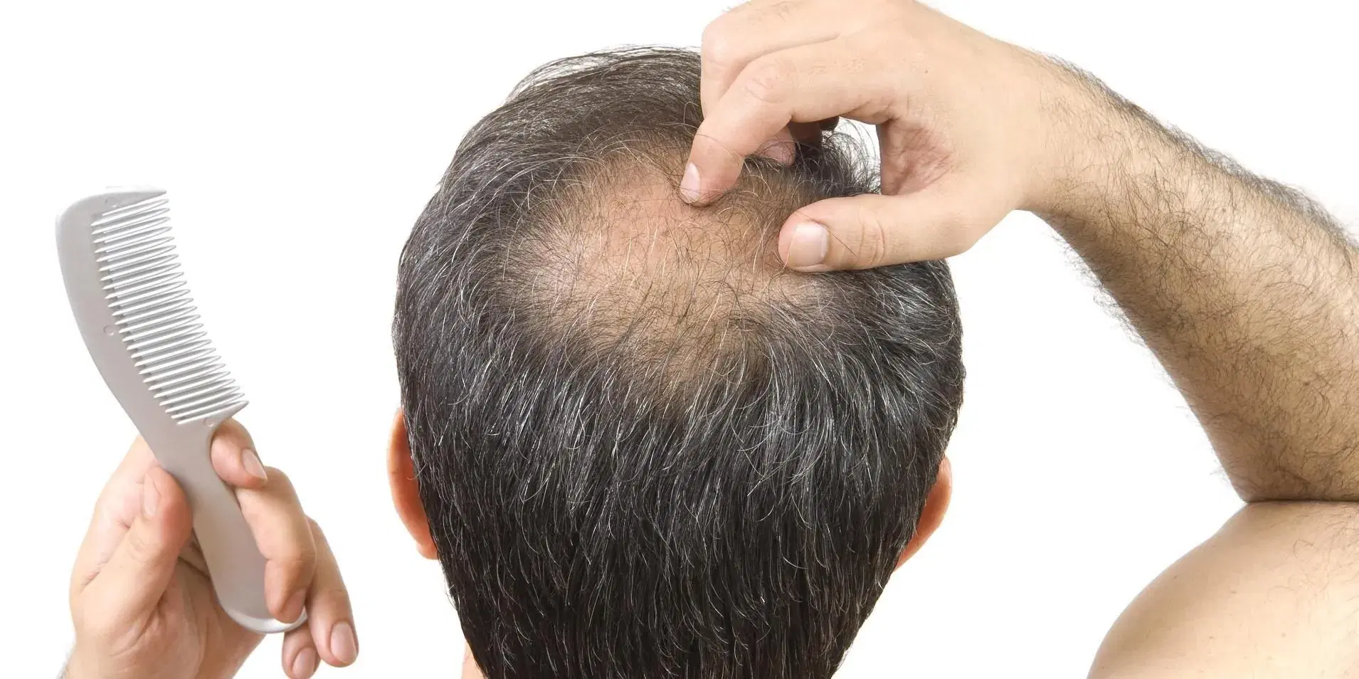 Does Thailand's Hot Climate Affect Hair Loss?