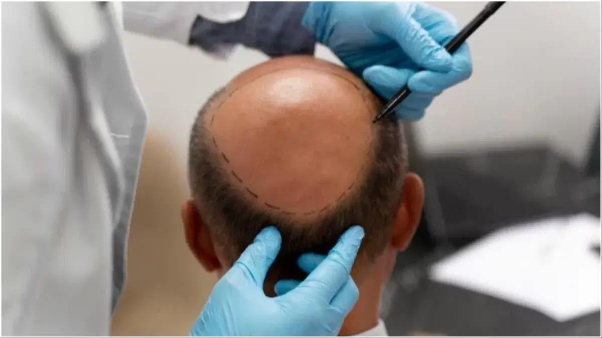 Bangkok vs Phuket for a Hair Transplant: Which Destination Is Better?